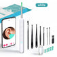 🎃Halloween Deal 50% OFF!🔥1080P Wireless Ear Wax Removal Camera Kit – See Clearly on Your Phone