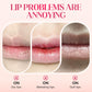 ⏳2026 NEW YEAR BUY 1 GET 1 FREE⚡50K+ SOLD!✨Nooni Apple Hydrating Moisturizer Plump Transfer-proof Glossy Lip Stain Oil💋