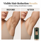 🔥New Hot Selling❤️‍🔥 Professional IPL Laser Hair Removal Device